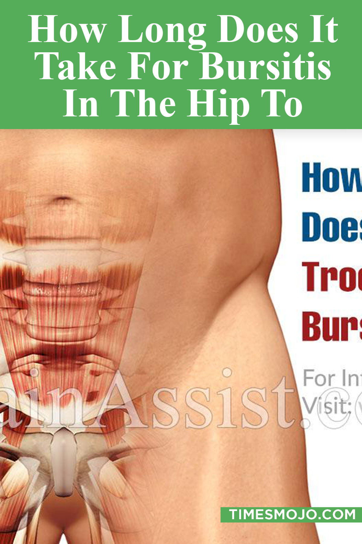 How Long Does It Take For Bursitis In The Hip To Heal Timesmojo