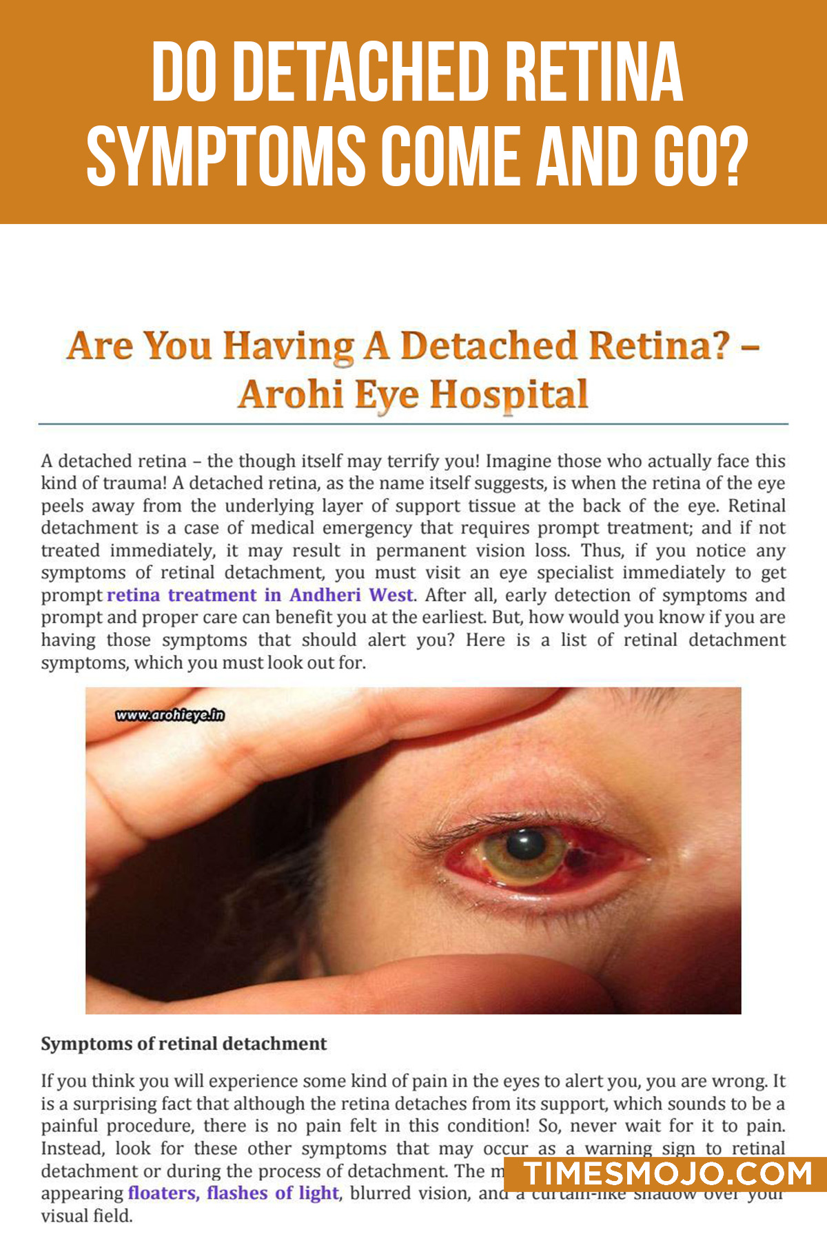 Do Detached Retina Symptoms Come And Go