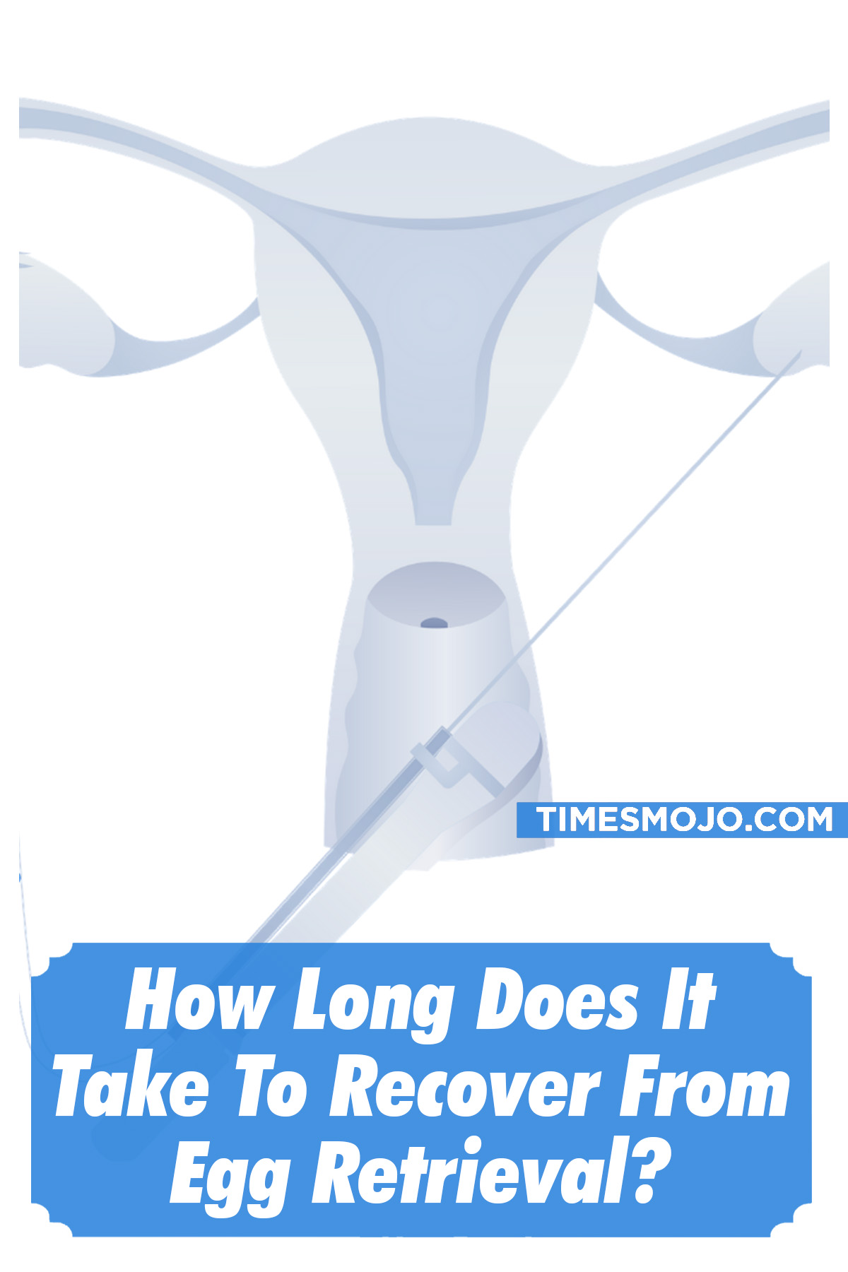 How Long Does It Take To Recover From Egg Retrieval