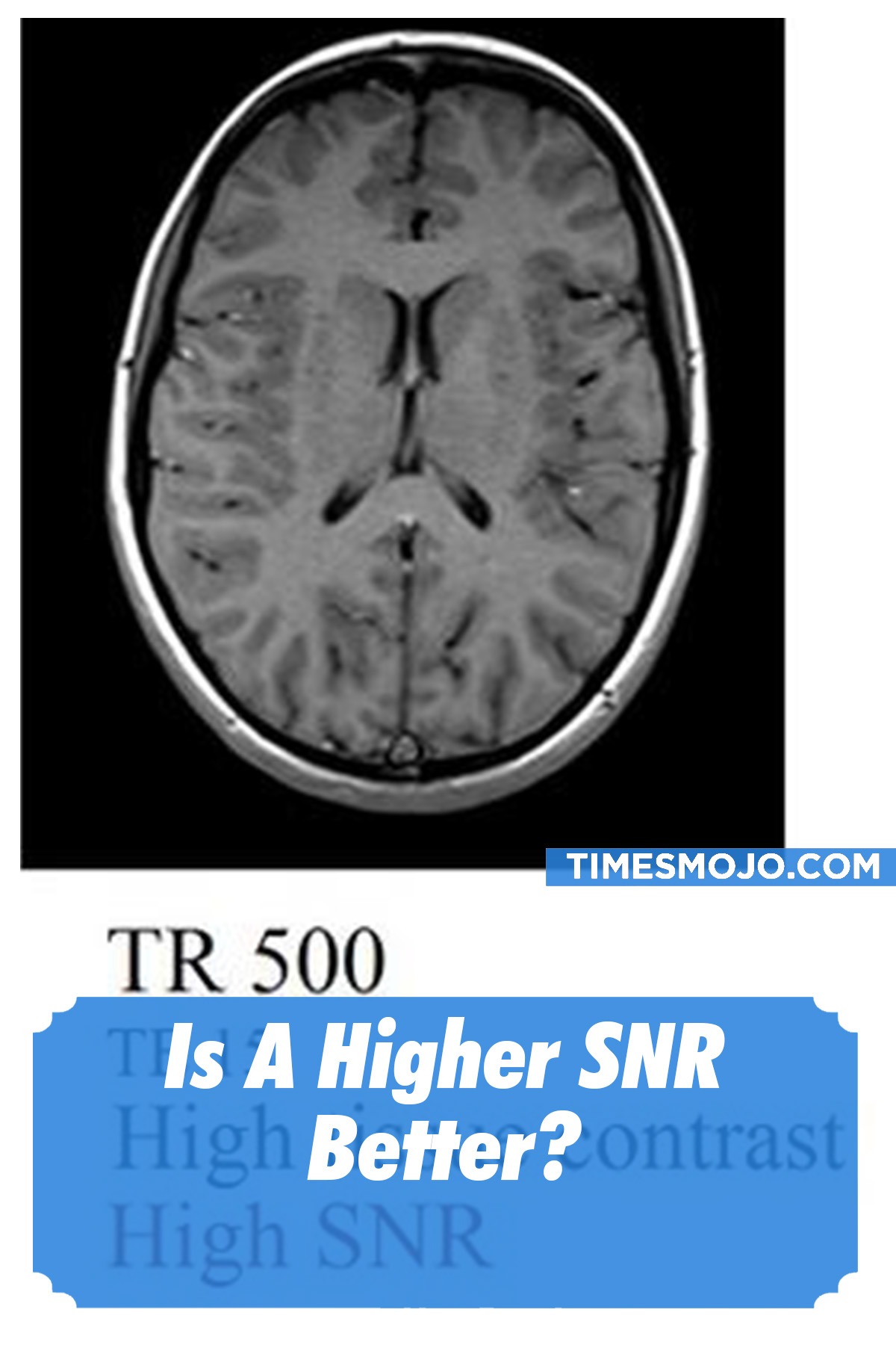 Is A Higher SNR Better