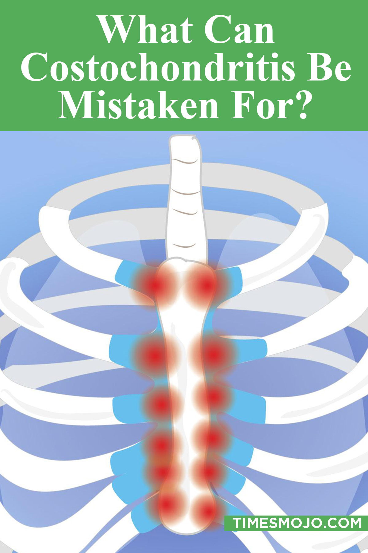 What Can Costochondritis Be Mistaken For